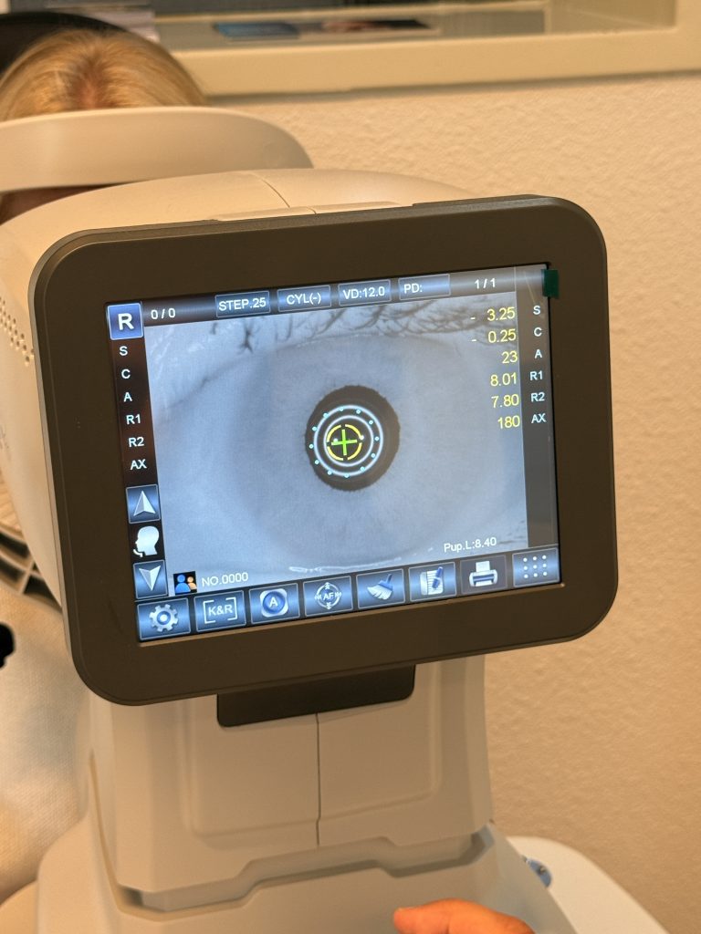 Netvliesfoto op het scherm tijdens een diabetes-oogonderzoek