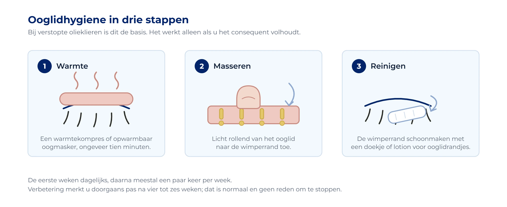 Ooglidhygiene in drie stappen: warmtekompres op de gesloten oogleden, masseren richting de wimperrand en reinigen van de ooglidrand
