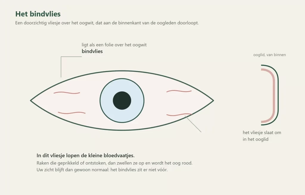 Het bindvlies over het oogwit en omgeslagen in het ooglid