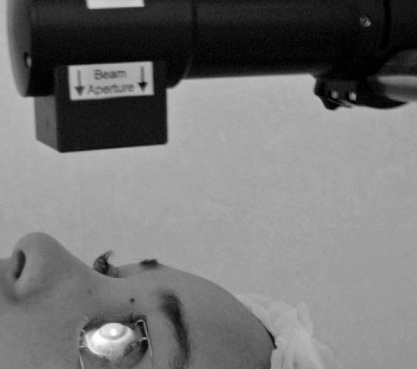 Crosslinking: na de riboflavinedruppels wordt het hoornvlies belicht met uv-licht