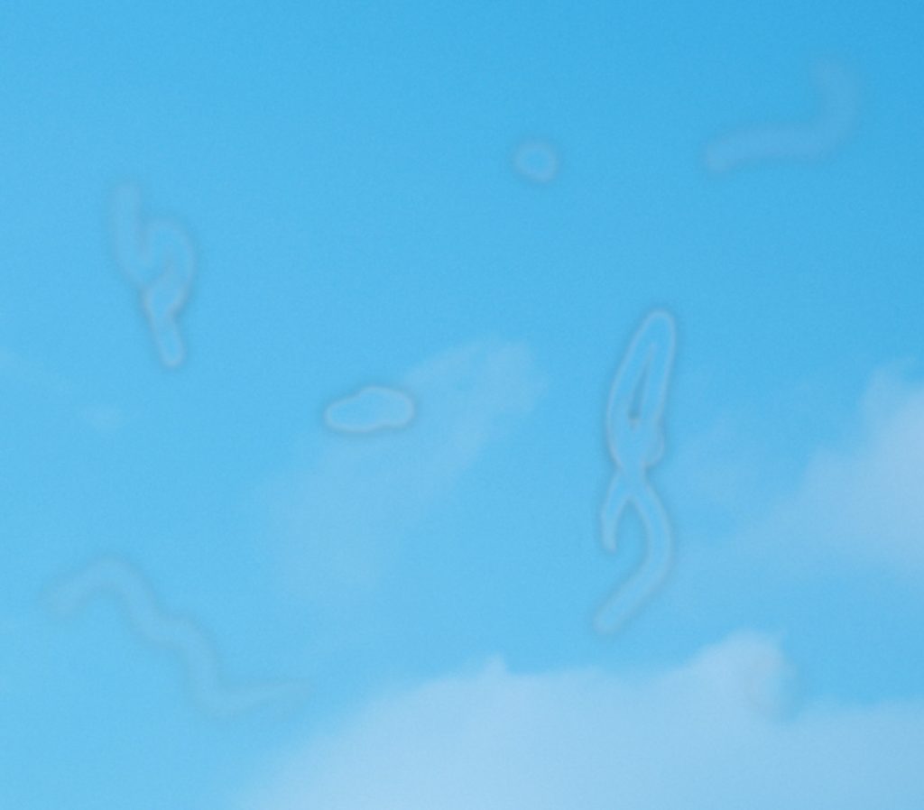 Zo kunnen zwevende vlekjes (mouches volantes) eruitzien als u naar een lichte lucht kijkt