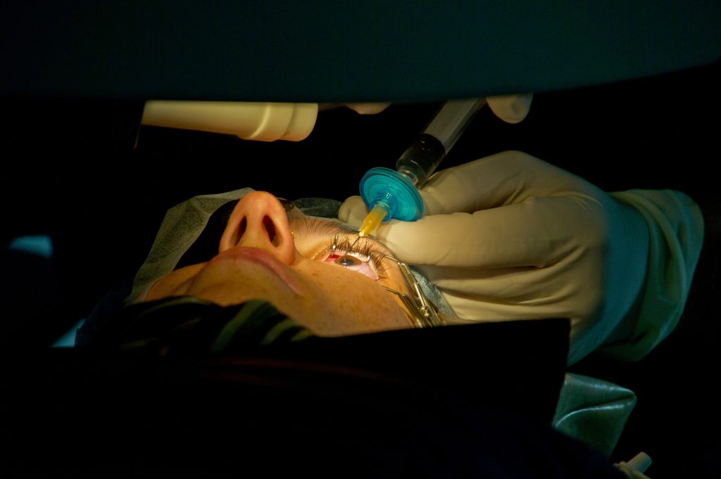 Tijdens het ooglaseren ligt u onder de laser en kijkt u naar een lampje